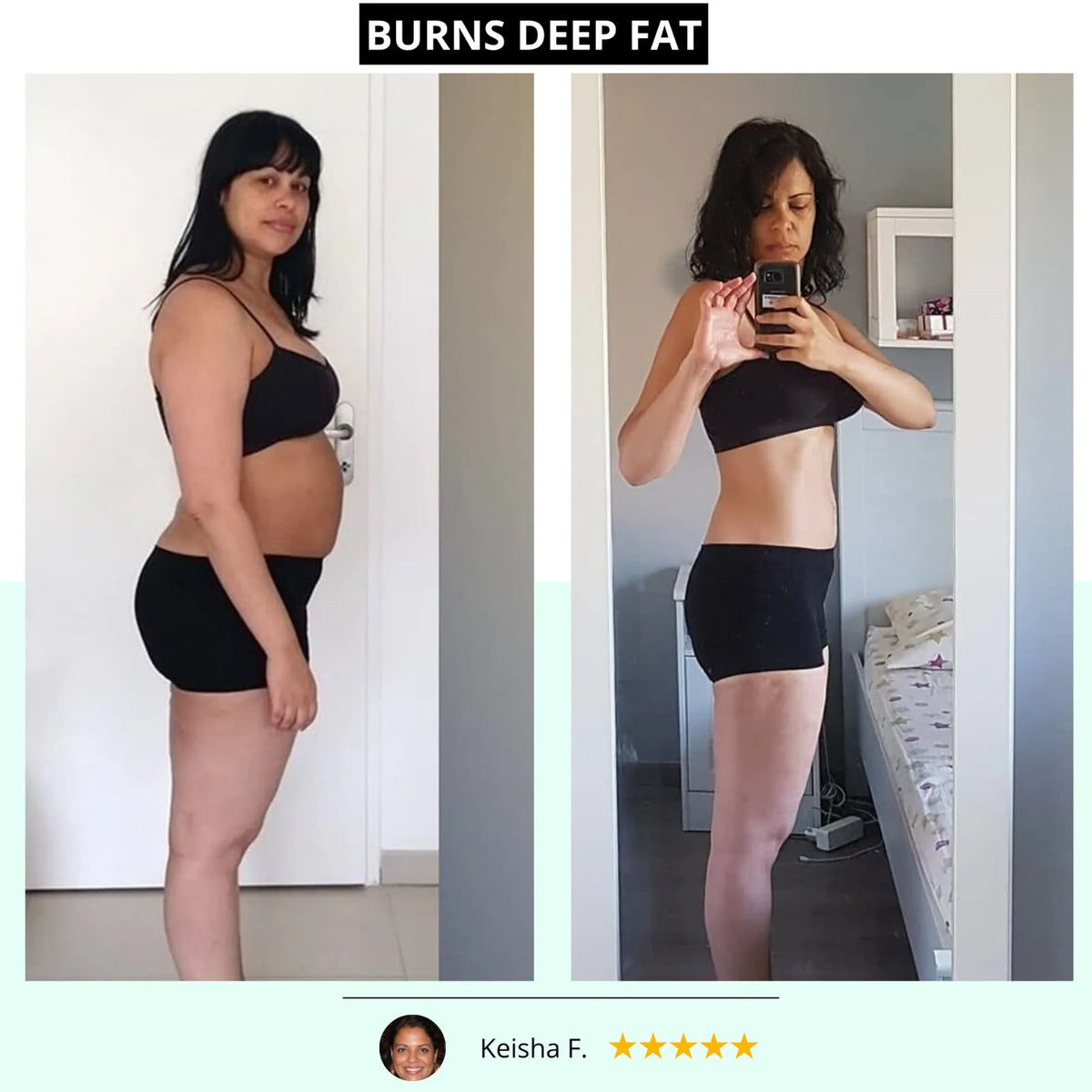 BODYSCULPT PRO™️ <br> Anti-Cellulite & Body Sculpting Device