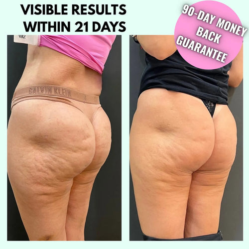 BODYSCULPT PRO™️ <br> Anti-Cellulite & Body Sculpting Device